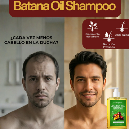 Shampoo de Batana con Romero – Fórmula Anticaída y Crecimiento Capilar 300ml 🍀